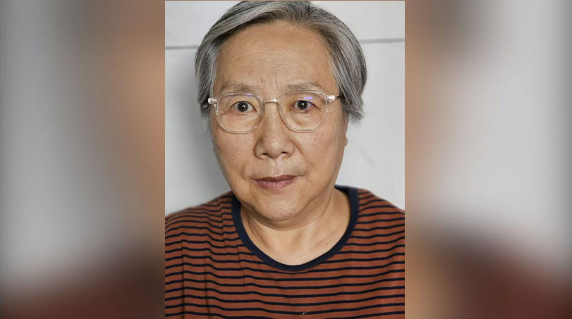 m0920-ql1p1.jpg 新娜患眼疾,右眼已经失明。(新娜提供)