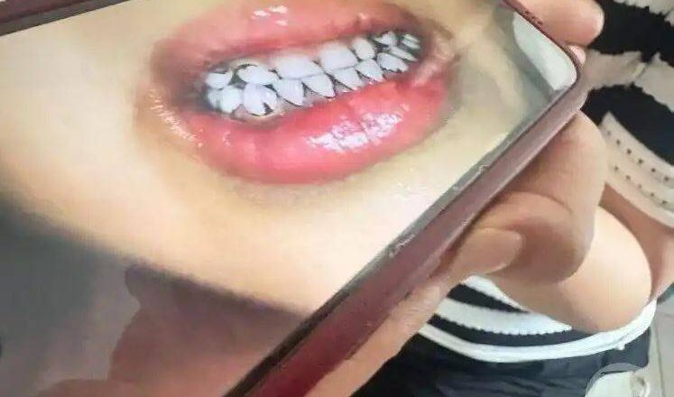 夭壽！中國幼兒園233童鉛中毒 竟是園長指示用顏料製作餐點