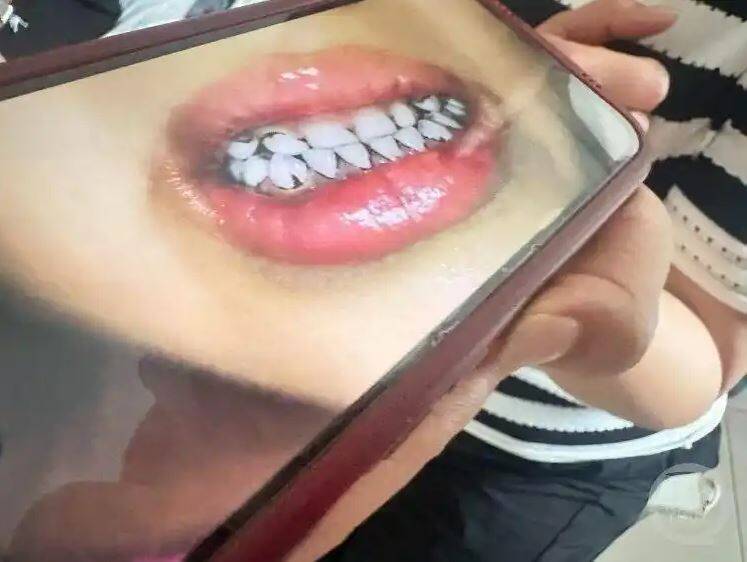 中国甘肃省天水市幼儿园有233名学童血铅浓度异常,竟是园长、投资人指示以颜料制作餐点酿祸。(图撷自微博) 中国甘肃省天水市幼儿园有233名学童血铅浓度异常,竟是园长、投资人指示以颜料制作餐点酿祸。(图撷自微博)