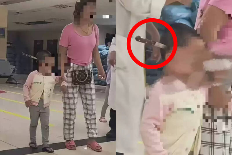中国云南一名3岁女童头上竟插著一把水果刀。(本报合成,撷取自微博) 中国云南一名3岁女童头上竟插著一把水果刀。(本报合成,撷取自微博)