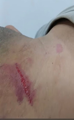 G1DoDSSacAAuRtL G1DoDSSacAAuRtL